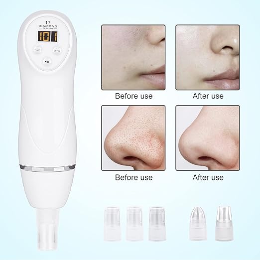 Diamond Microdermabrasion Machine Blackhead Remover